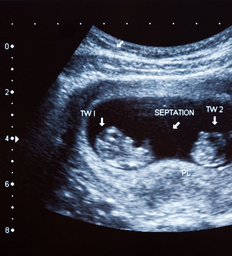 My Baby Gender